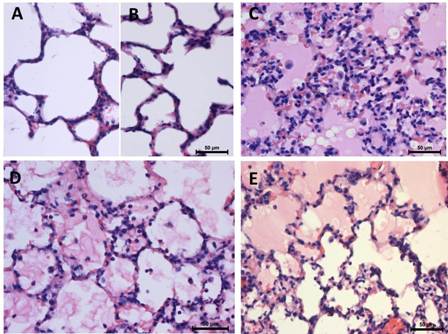 Figure 1:  Effect of oleic acid and LS in lung. Normal histological structure of lung with open alveolar spaces, type II and flat type I pneumocytes in group I (A) and group III (B) Hyaline membranes, intraalveoalar inflammatory cells in group II (C) LS in group IV (D) and group V (E) attenuated the lung pathology( Hematoxylin-eosin, X400)